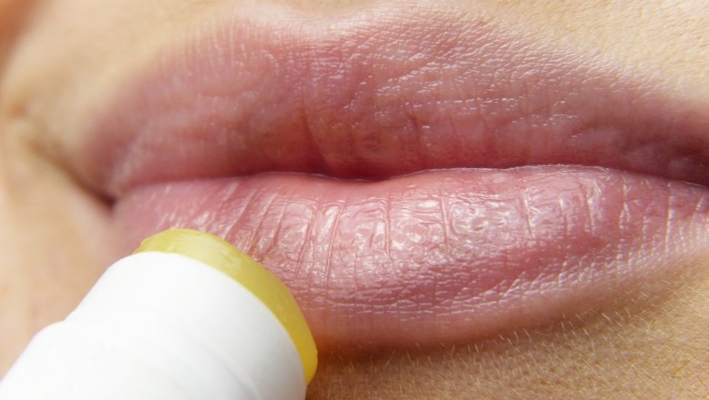 Foods To Avoid With Cold Sores, Fever Blisters and Oral Herpes