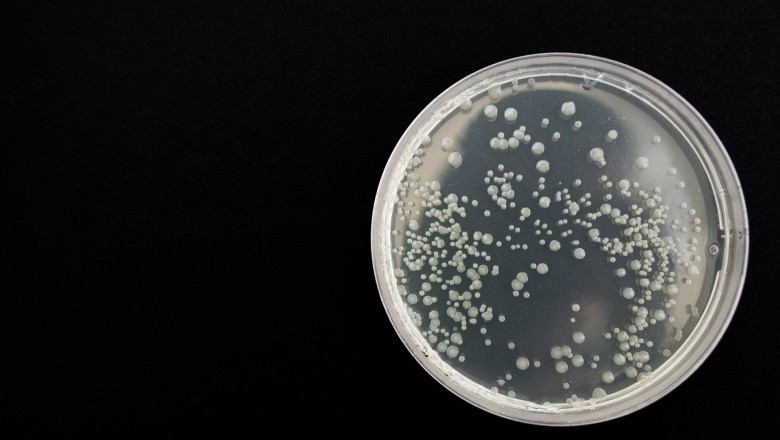 How To Diagnose And Treat Baby Yeast Infection On Face by Acting On The Spot