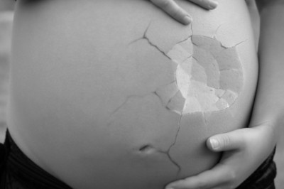 When Do Most Miscarriages Occur?  5 Top Risk Time Periods