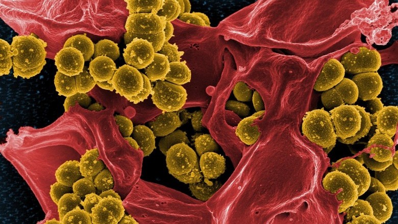 Causes of Staph Infection and Symptoms of Staph Infection