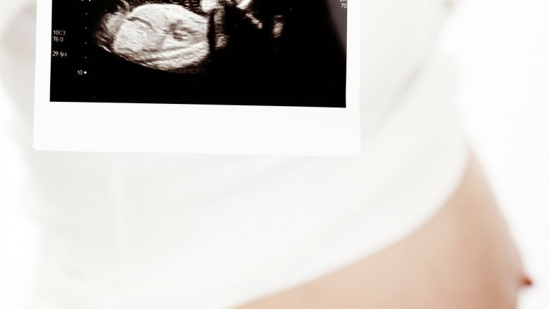Baby Movements During Pregnancy 